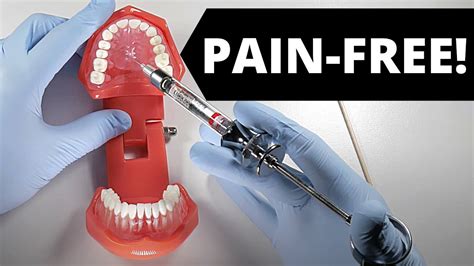 Deliver A Painless Palatal Injection Youtube