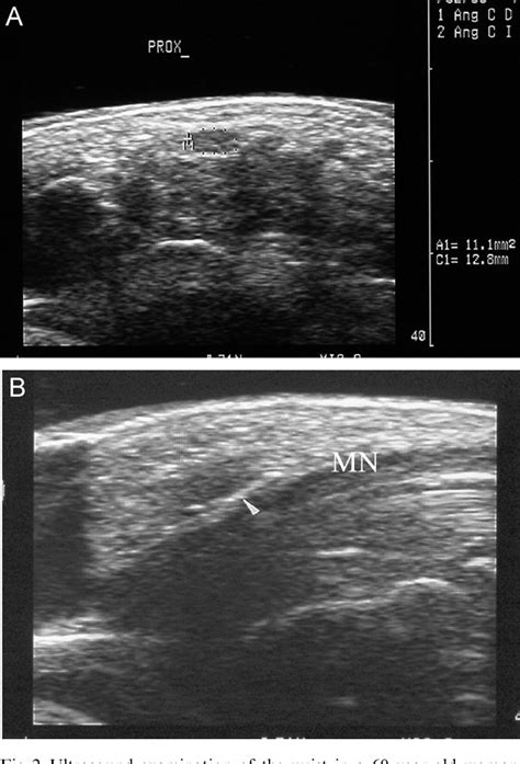 Figure 2 From The Usefulness Of Ultrasonography In The Diagnosis Of