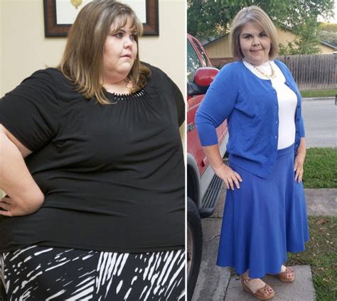 My 600 Lb Life Before And After Photos — Where Are They Now