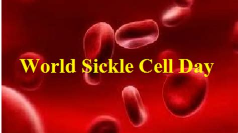 World Sickle Cell Day 2019 Current Theme History And Significance