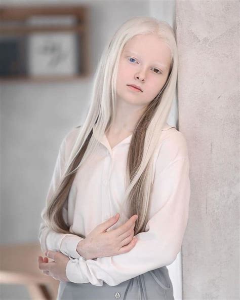 Mujer Albina Caucásica
