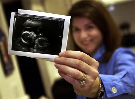 find out why one woman s fake ultrasound photo has over 60 000 shares on facebook life and style