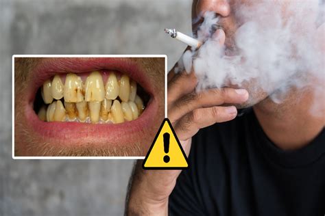 5 ways smoking affects your teeth the dental district
