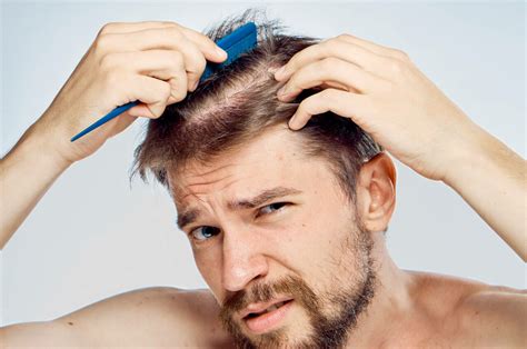 Thinning Hair Why It Happens And How To Deal With It Myhair