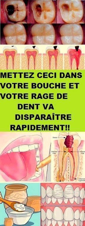 Épinglé sur santé