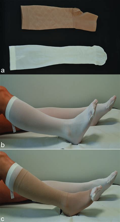 Compression Therapy In Patients With Venous Leg Ulcers Dissemond