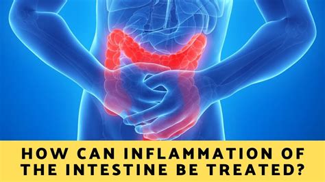 How Can Inflammation Of The Intestine Be Treated Youtube