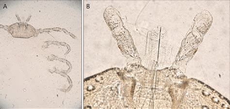 Optical Microscopic Finding Of Nymphal Amblyomma Testudinarium A