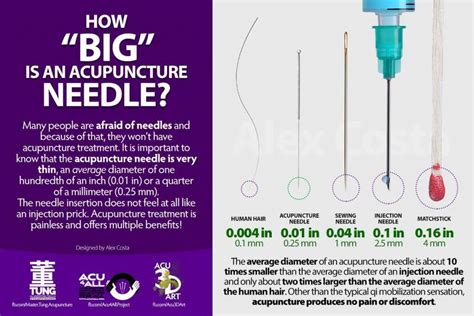 How Big Are Acupuncture Needles Mango Acupuncture