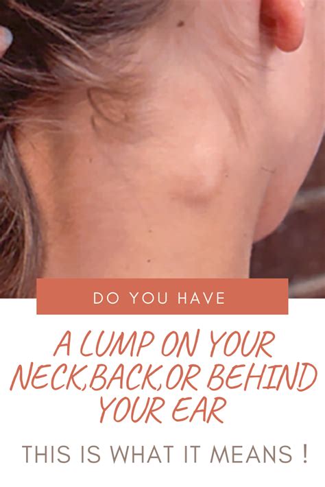 Do You Have A Lump On Your Neck Back Or Behind Your Ear This Is What It Means Hello Healthy