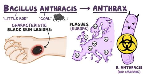 Bacillus Anthracis Anthrax Video And Anatomy Osmosis