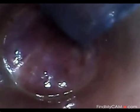 Test Tube Cock Endoscope Pov Urethral Insertion Ball Rod