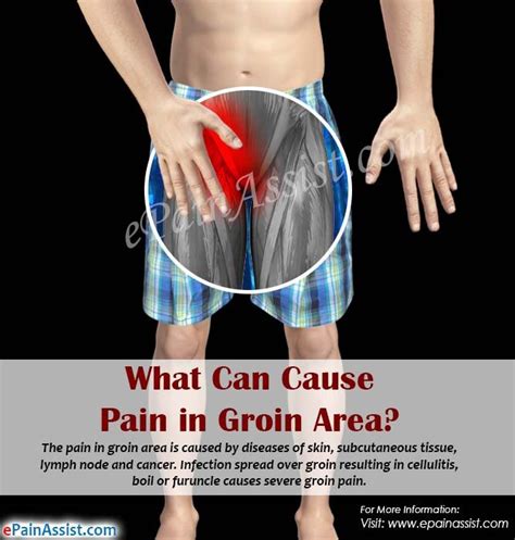 Female Lower Back And Groin Pain Do You Need To Get Checked Hot Sex