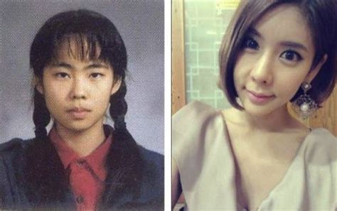 This tangible effect is hard to miss. Here are 30 Most Shocking Korean Before and After Plastic ...