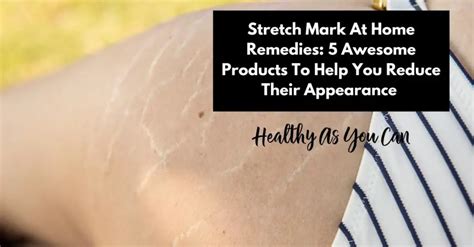 Stretch Mark At Home Remedies 5 Awesome Products To Help You Reduce