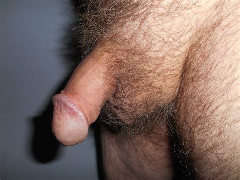 File Circumcised Penis Wikimedia Commons