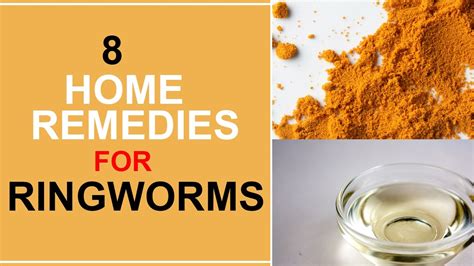 8 Home Remedies For Ringworms Youtube