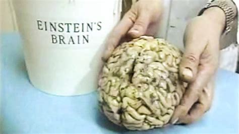 Einsteins Brain Its All About Connections Simply Charly