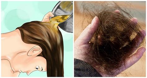 Ternyata Begini Cara Mengatasi Rambut Rontok Secara Cepat ...