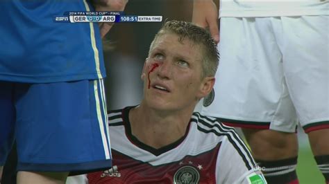 Bastian Schweinsteiger is bleeding - SBNation.com