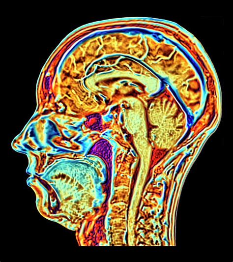 Mri Scan Of Normal Brain Photograph By Alfred Pasiekascience Photo Library