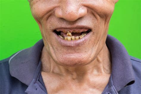 Face Ugly Old Man Stock Photos Download 287 Royalty Free Photos