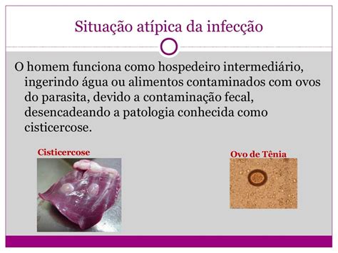 Qual A Diferença Entre Teniase E Cisticercose