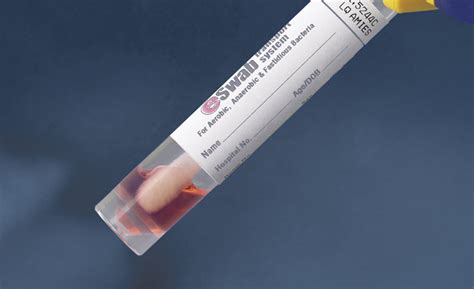 Before your appointment, you might want to write a list that includes: rapidmicrobiology ESwab's Versatility And Efficacy To ...