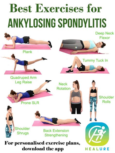ankylosing spondylitis exercise online degrees