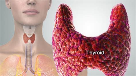 8 Signs That Indicate Problem With Thyroid Gland Youtube