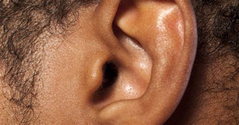 Bug In Ear Symptoms And How To Get It Out