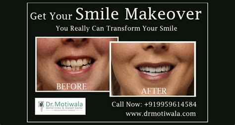 Best Dental Clinic And Implants Center Dr Motiwala