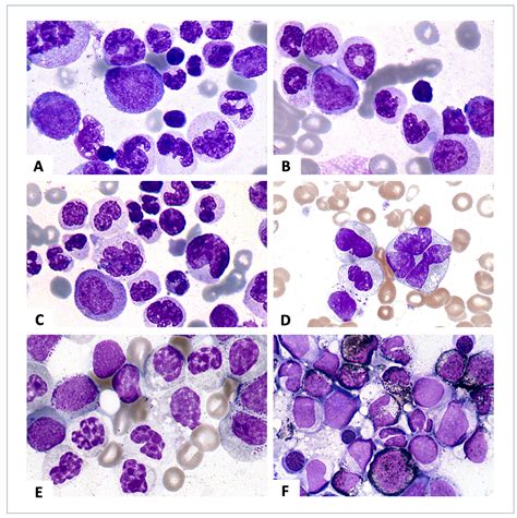 Images From The Haematologica Atlas Of Hematologic Cytology