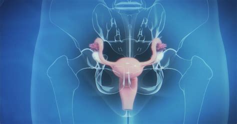 Learn more about the types, symptoms, causes, diagnosis, stages, treatment, and. Endometriosis: Symptoms, Causes, and Treatment - Hello ...