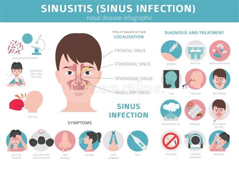 Nasal Diseases Sinusitis Sinus Infection Diagnosis And Treatment