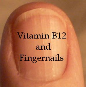 Commonly, older adults develop such lines due to the decrease in the process of cell. Vitamin B12 and Fingernails - Your Roadmap to Health ...