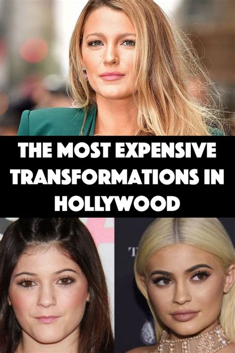 It Cost Them An Arm And A Leg The Most Expensive Celeb Plastic Surgeries Celebrity Plastic