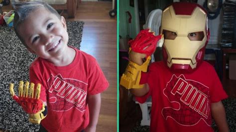 German cyberweapons hobbyist patrick priebe is apparently a big fan of iron man. 3-Year-Old Born Without Fingers Gets Sick New 'Iron Man' Prosthetic Hand - Sick Chirpse