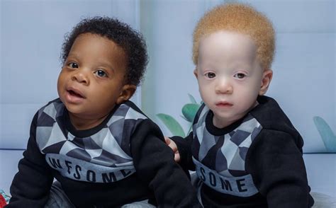 mother s set of twins are identical but look nothing alike