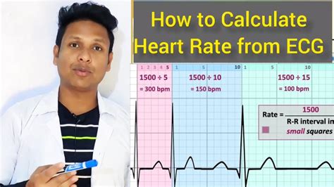 Method Of Heart Rate Calculation How To Calculate Heart Rate From Ecg