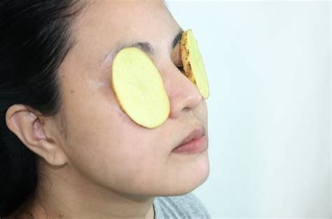 Home Remedies for Itchy Eyes Treatment