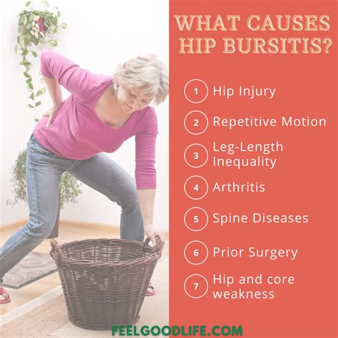 Best Hip Bursitis Exercises For Seniors Artofit