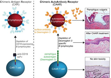 Caar Treating Autoimmune Dise Image Eurekalert Science News Releases