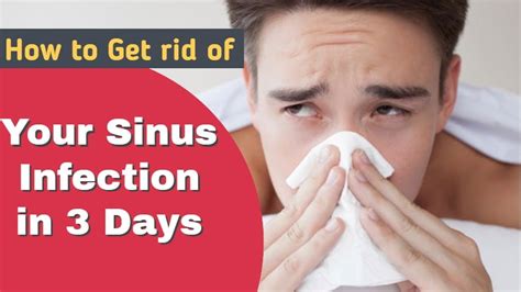 How To Get Rid Of Your Sinus Infection In 3 Days Youtube