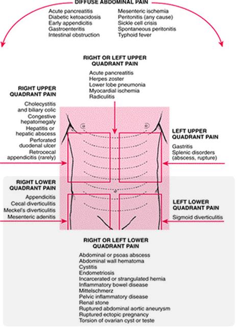 Abdominal Pain Chart Male