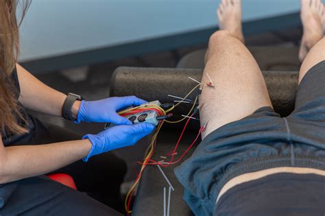 Chiropractic Dry Needling In Kansas City F I T Muscle And Joint Clinic