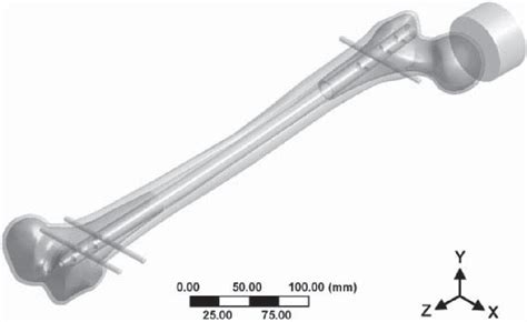 Fe Model Of The T2 Nailsynthetic Femur Assembly For The Aa Off