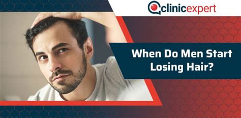 Some, like me, don't lose their hair. When Do Men Start Losing Hair? | ClinicExpert International