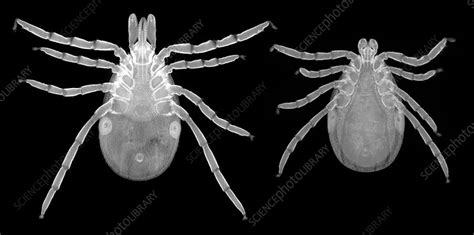 Lyme Disease Ticks Light Micrograph Stock Image C0376449