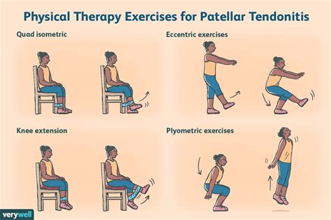 Best Exercises To Rehab Patellar Tendinitis Patellar Tendonitis My